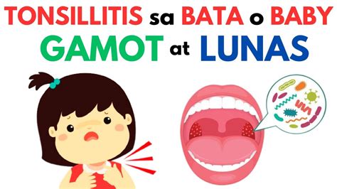 gamot para sa tonsil ng bata